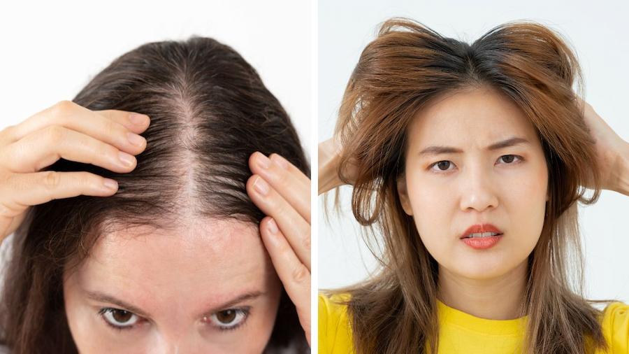 hair loss vs flat hair